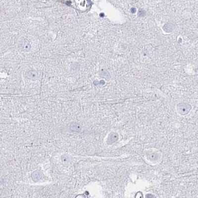 Immunohistochemistry-Paraffin: Intra Acrosomal Protein Antibody [NBP1-88038]
