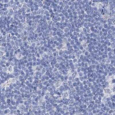 Immunohistochemistry-Paraffin: Intra Acrosomal Protein Antibody [NBP1-88038]