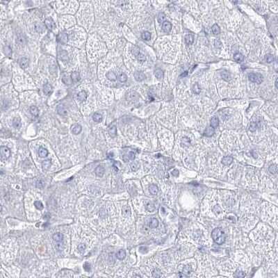 Immunohistochemistry-Paraffin: Intra Acrosomal Protein Antibody [NBP1-88038]