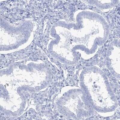 Immunohistochemistry-Paraffin: Intra Acrosomal Protein Antibody [NBP2-34054]