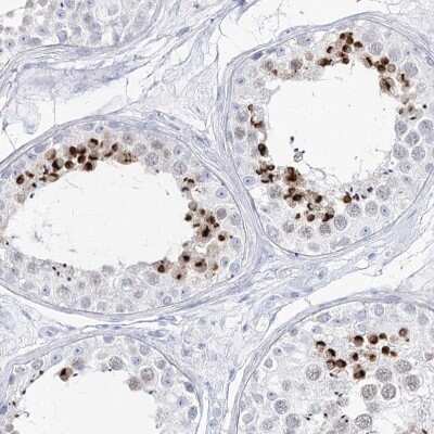 Immunohistochemistry-Paraffin: Intra Acrosomal Protein Antibody [NBP2-34054]