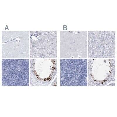 Immunohistochemistry-Paraffin: Intra Acrosomal Protein Antibody [NBP2-34054]