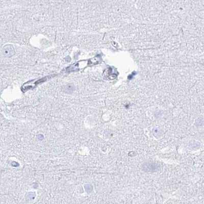 Immunohistochemistry-Paraffin: Intra Acrosomal Protein Antibody [NBP2-34054]