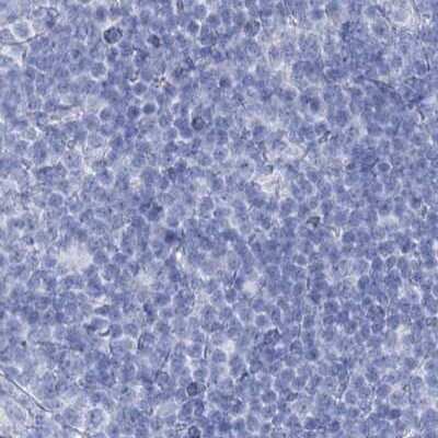 Immunohistochemistry-Paraffin: Intra Acrosomal Protein Antibody [NBP2-34054]