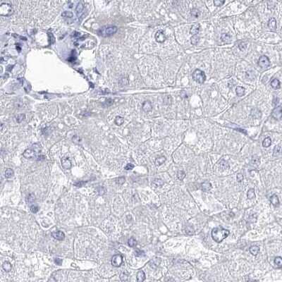 Immunohistochemistry-Paraffin: Intra Acrosomal Protein Antibody [NBP2-34054]