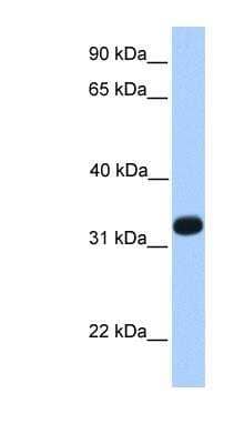 Western Blot: Intra Acrosomal Protein Antibody [NBP1-79534]