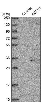 Western Blot: Intra Acrosomal Protein Antibody [NBP1-88038]