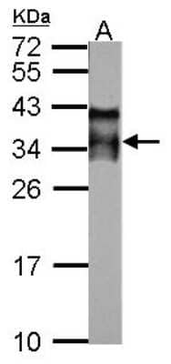 Western Blot: Intra Acrosomal Protein Antibody [NBP2-16978]