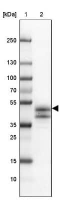 Western Blot: Intra Acrosomal Protein Antibody [NBP2-34054]