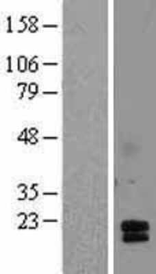 Western Blot: Intra Acrosomal Protein Overexpression Lysate [NBL1-07257]