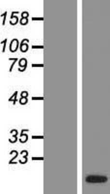 Western Blot: Intra Acrosomal Protein Overexpression Lysate [NBP2-06687]