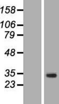 Western Blot: Intra Acrosomal Protein Overexpression Lysate [NBP2-06691]