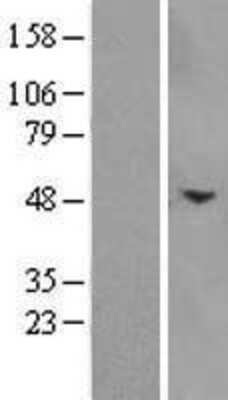 Western Blot: Intra Acrosomal Protein Overexpression Lysate [NBP2-10987]