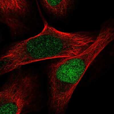 Immunocytochemistry/ Immunofluorescence: Intron-Binding Protein Of 160 KDa Antibody [NBP2-55806]