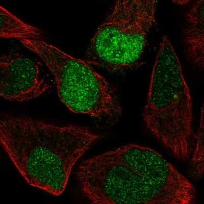 Immunocytochemistry/ Immunofluorescence: Intron-Binding Protein Of 160 KDa Antibody [NBP2-57794]