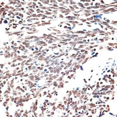 Immunohistochemistry-Paraffin: Intron-Binding Protein Of 160 KDa Antibody - Azide and BSA Free [NBP3-03714]