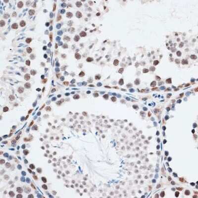 Immunohistochemistry-Paraffin: Intron-Binding Protein Of 160 KDa Antibody - Azide and BSA Free [NBP3-03714]