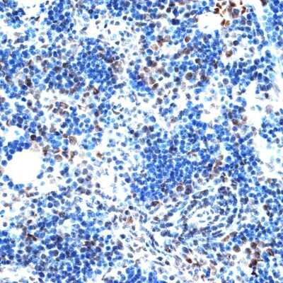 Immunohistochemistry-Paraffin: Intron-Binding Protein Of 160 KDa Antibody - Azide and BSA Free [NBP3-03714]