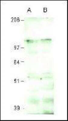 Western Blot: Intron-Binding Protein Of 160 KDa Antibody [NBP2-23607]