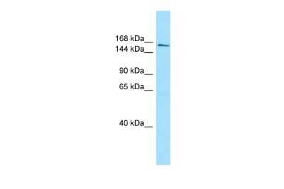 Western Blot: Intron-Binding Protein Of 160 KDa Antibody [NBP2-87631]