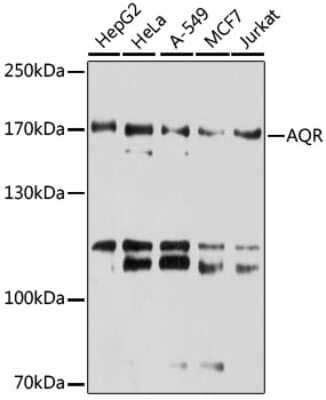 Western Blot: Intron-Binding Protein Of 160 KDa AntibodyAzide and BSA Free [NBP3-03714]