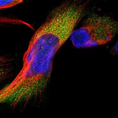 Immunocytochemistry/ Immunofluorescence: Invadolysin Antibody [NBP1-92024]