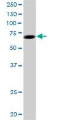 Western Blot: Invadolysin Antibody [H00089782-B01P]