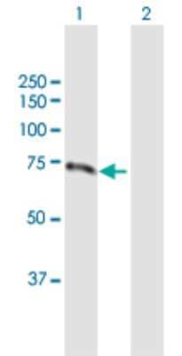 Western Blot: Invadolysin Antibody [H00089782-B01P]
