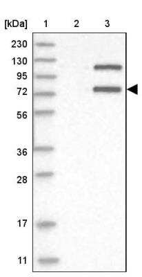 Western Blot: Invadolysin Antibody [NBP1-92025]