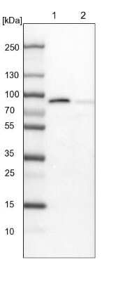 Western Blot: Invadolysin Antibody [NBP1-92025]