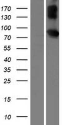 Western Blot: Invadolysin Overexpression Lysate [NBP2-11081]