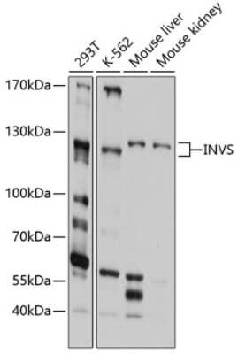 Western Blot: Inversin AntibodyBSA Free [NBP3-03537]