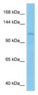 Western Blot: Inversin Antibody [NBP3-10988]