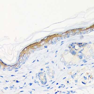 Immunohistochemistry-Paraffin: Involucrin Antibody (8H7B3) [NBP3-15461]