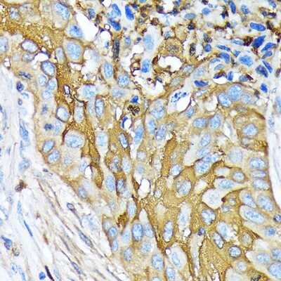 Immunohistochemistry-Paraffin: Involucrin Antibody (8H7B3) [NBP3-15461]