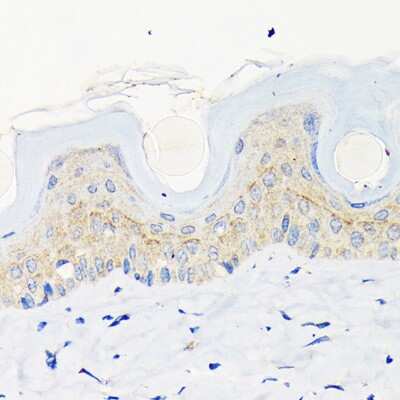Immunohistochemistry-Paraffin: Involucrin Antibody (8H7B3) [NBP3-15461]