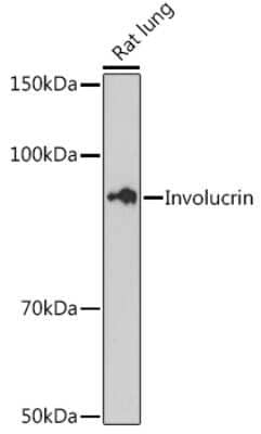 Western Blot: Involucrin Antibody (8H7B3) [NBP3-15461]