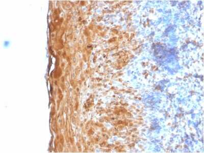 Immunohistochemistry-Paraffin: Involucrin Antibody (IVRN/2113R) - Azide and BSA Free [NBP3-08386]