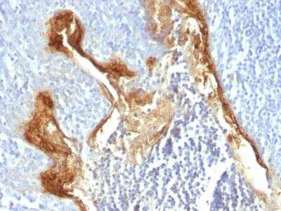 Immunohistochemistry-Paraffin: Involucrin Antibody (IVRN/827) - IHC-Prediluted [NBP2-48274]