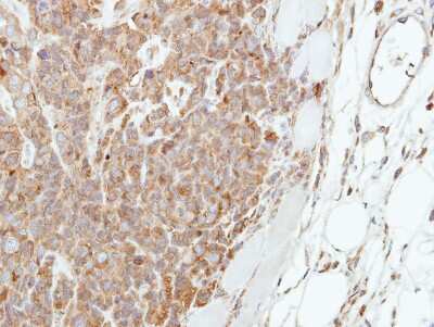 Immunohistochemistry-Paraffin: Involucrin Antibody [NBP2-16981]