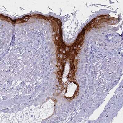 Immunohistochemistry-Paraffin: Involucrin Antibody [NBP2-33742]