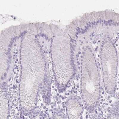Immunohistochemistry-Paraffin: Involucrin Antibody [NBP2-33742]