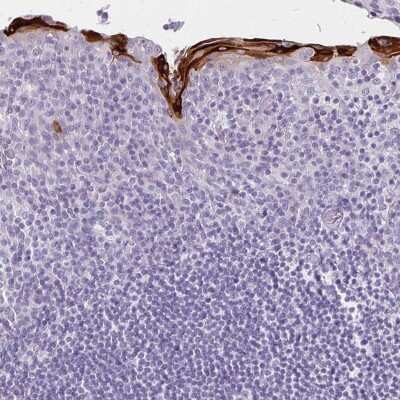 Immunohistochemistry-Paraffin: Involucrin Antibody [NBP2-33742]