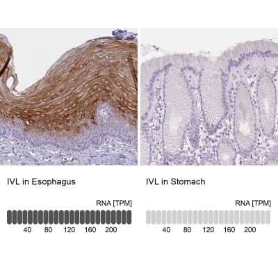 Immunohistochemistry-Paraffin: Involucrin Antibody [NBP2-33742]