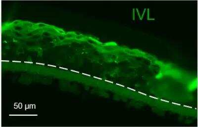 Immunohistochemistry-Paraffin: Involucrin Antibody [NBP2-33742]