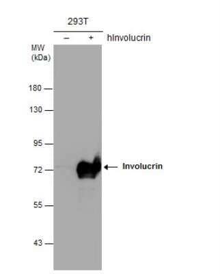 Western Blot: Involucrin Antibody [NBP2-16981]
