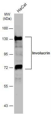 Western Blot: Involucrin Antibody [NBP2-16981]