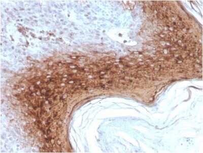 Immunohistochemistry-Paraffin: Involucrin Antibody (rIVRN/827) - Azide and BSA Free [NBP3-08292]