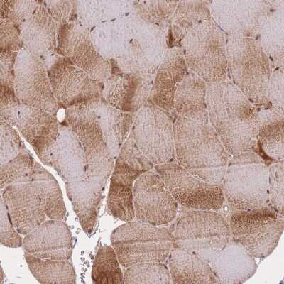 Immunohistochemistry-Paraffin: Irisin/FNDC5 Antibody [NBP2-14024]