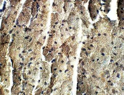 Immunohistochemistry-Paraffin: Irisin/FNDC5 Antibody [NBP3-12317]